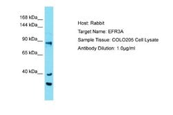 EFR3A Antibody, Novus Biologicals 100 &mu;L | Buy Online | Novus Biologicals | Fisher Scientific